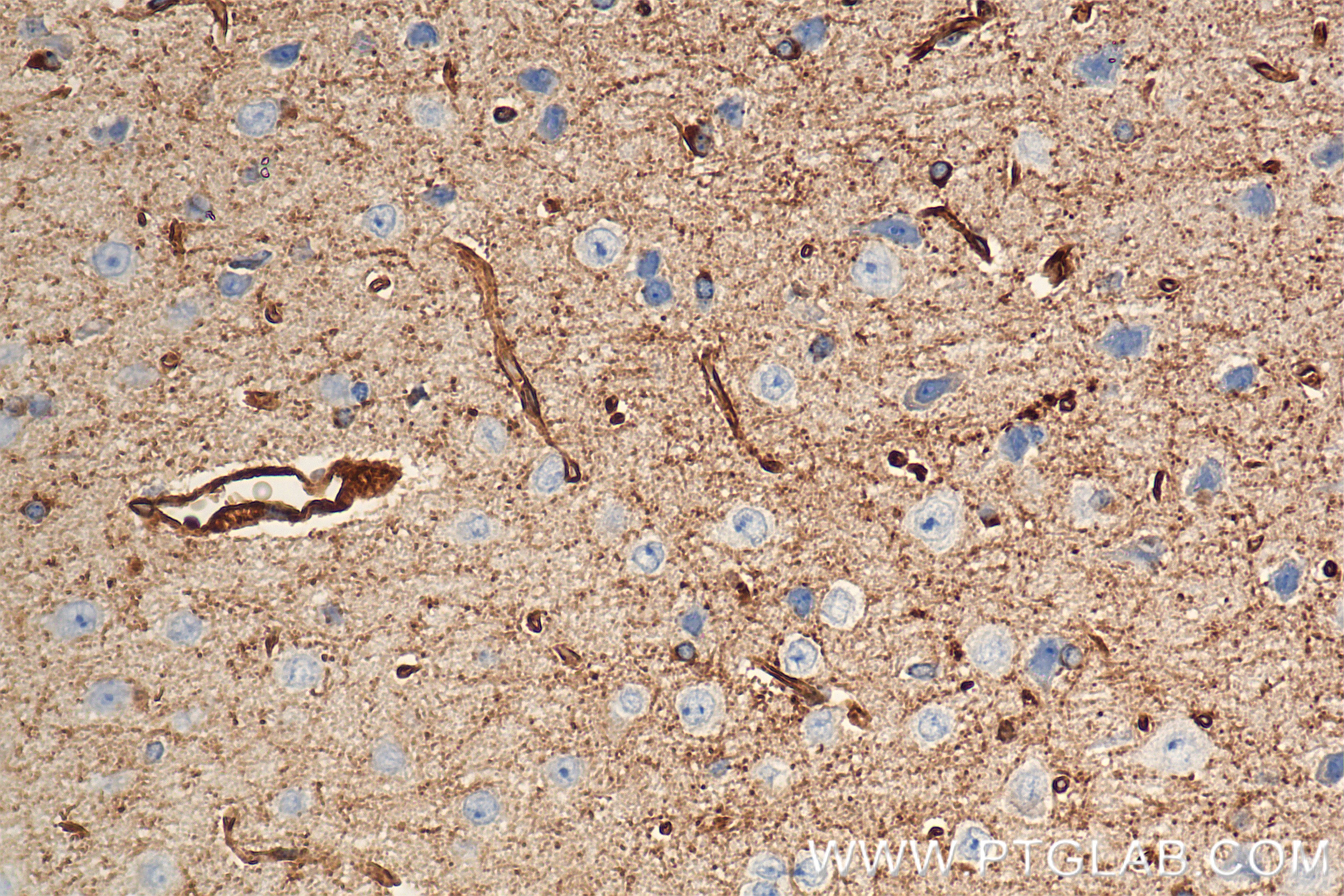 Immunohistochemistry (IHC) staining of mouse brain tissue using VAT1 Recombinant monoclonal antibody (86847-1-RR)