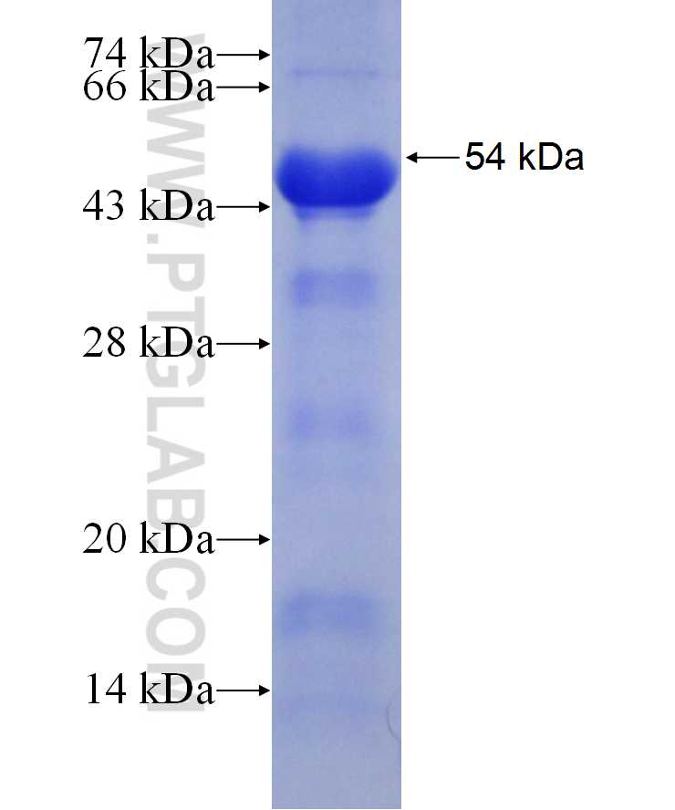 VAT1 fusion protein Ag29812 SDS-PAGE