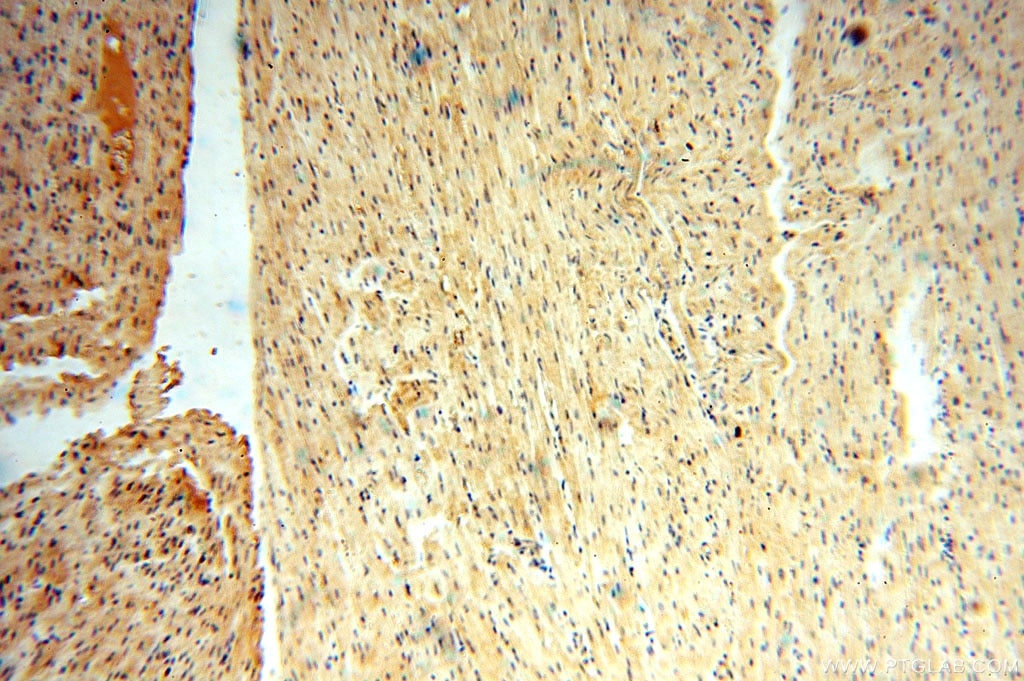 Immunohistochemistry (IHC) staining of human heart tissue using VAV1 Polyclonal antibody (16364-1-AP)