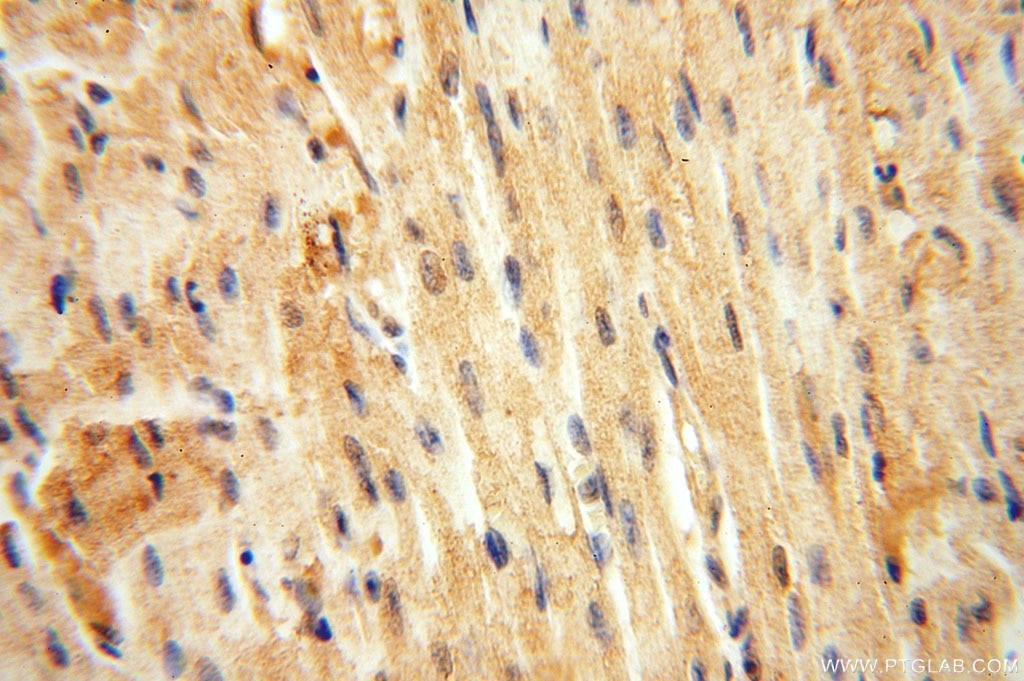 IHC staining of human heart using 16364-1-AP