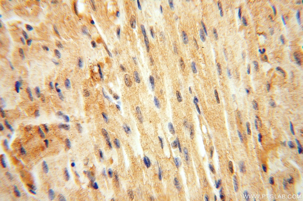 Immunohistochemistry (IHC) staining of human heart tissue using VAV1 Polyclonal antibody (16364-1-AP)