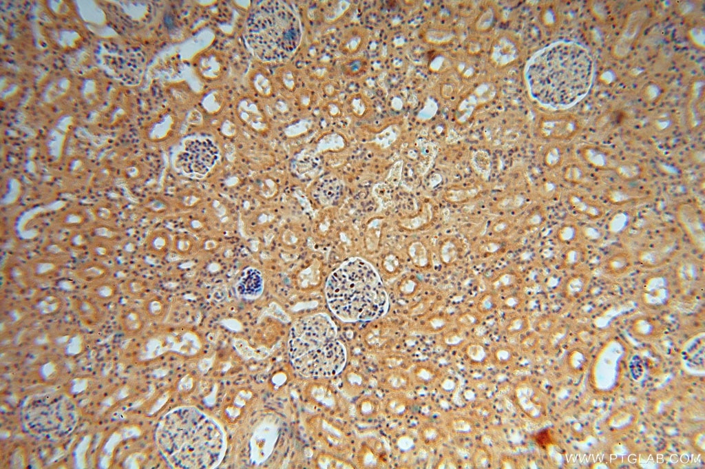 Immunohistochemistry (IHC) staining of human kidney tissue using VAV1 Polyclonal antibody (16364-1-AP)