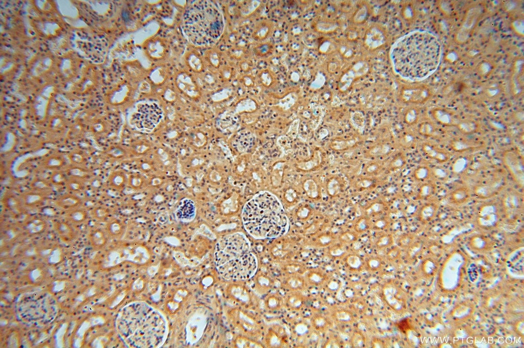 IHC staining of human kidney using 16364-1-AP