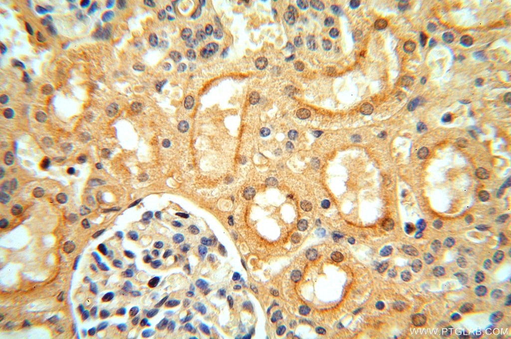 Immunohistochemistry (IHC) staining of human kidney tissue using VAV1 Polyclonal antibody (16364-1-AP)