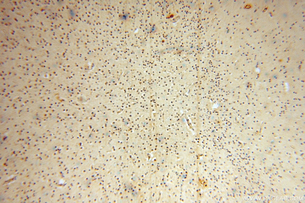 Immunohistochemistry (IHC) staining of human brain tissue using VAV1 Polyclonal antibody (16364-1-AP)
