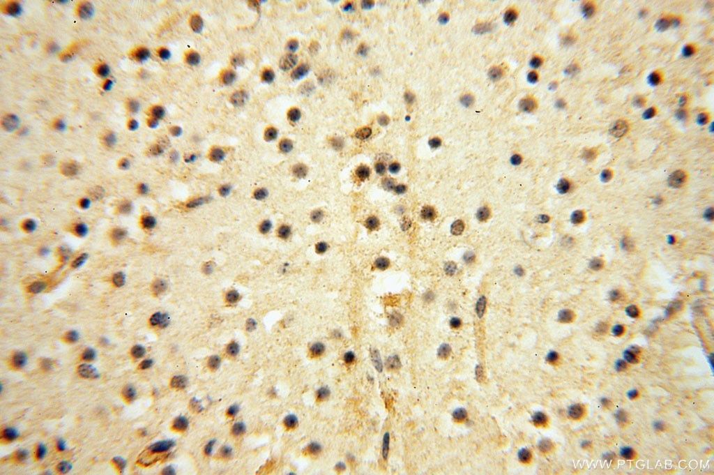 Immunohistochemistry (IHC) staining of human brain tissue using VAV1 Polyclonal antibody (16364-1-AP)