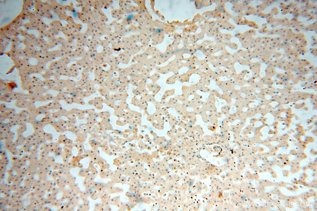 Immunohistochemistry (IHC) staining of human liver tissue using VAV1 Polyclonal antibody (16364-1-AP)