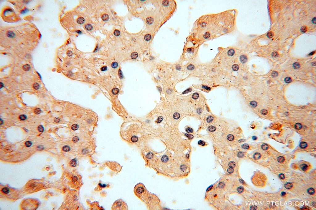 Immunohistochemistry (IHC) staining of human liver tissue using VAV1 Polyclonal antibody (16364-1-AP)