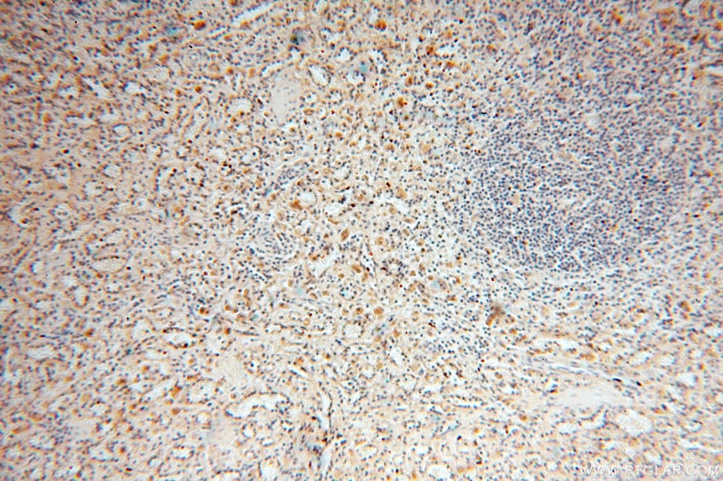 Immunohistochemistry (IHC) staining of human spleen tissue using VAV1 Polyclonal antibody (16364-1-AP)