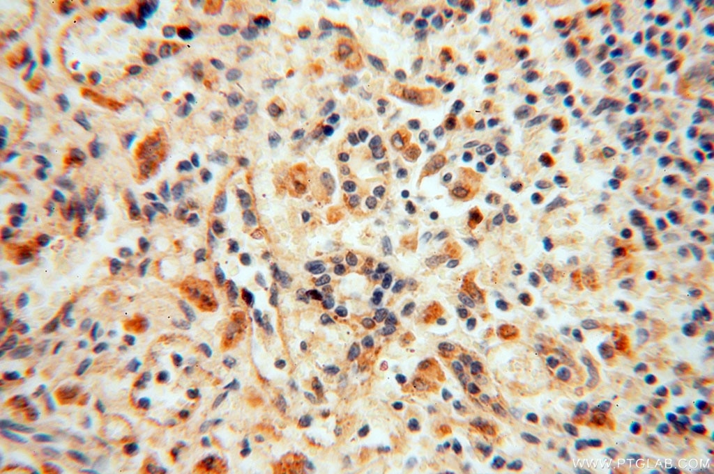 Immunohistochemistry (IHC) staining of human spleen tissue using VAV1 Polyclonal antibody (16364-1-AP)