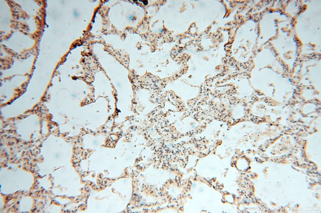 Immunohistochemistry (IHC) staining of human lung tissue using VAV1 Polyclonal antibody (16364-1-AP)