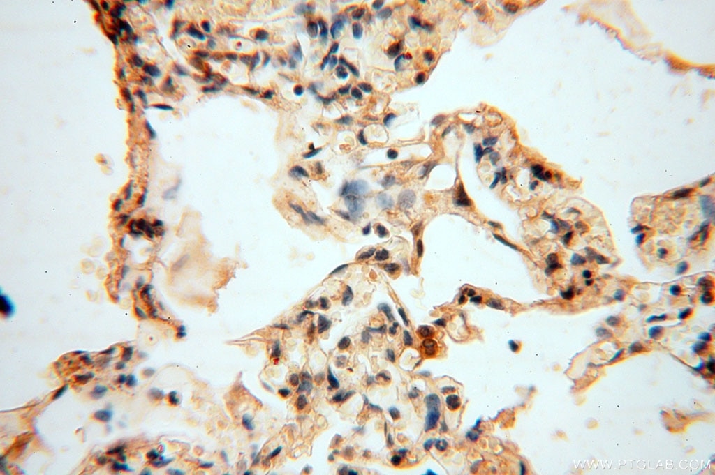 Immunohistochemistry (IHC) staining of human lung tissue using VAV1 Polyclonal antibody (16364-1-AP)