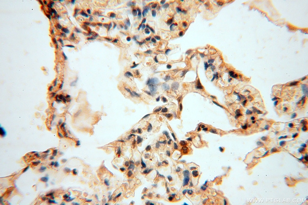 Immunohistochemistry (IHC) staining of human lung tissue using VAV1 Polyclonal antibody (16364-1-AP)