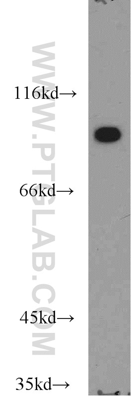 Western Blot (WB) analysis of Jurkat cells using VAV1 Polyclonal antibody (16364-1-AP)