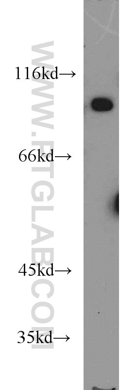 Western Blot (WB) analysis of K-562 cells using VAV1 Polyclonal antibody (16364-1-AP)