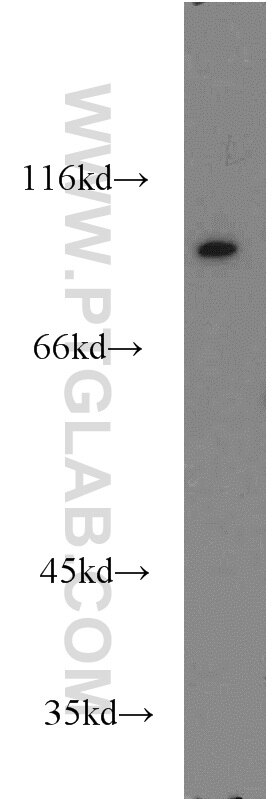 Western Blot (WB) analysis of Jurkat cells using VAV1 Polyclonal antibody (16364-1-AP)