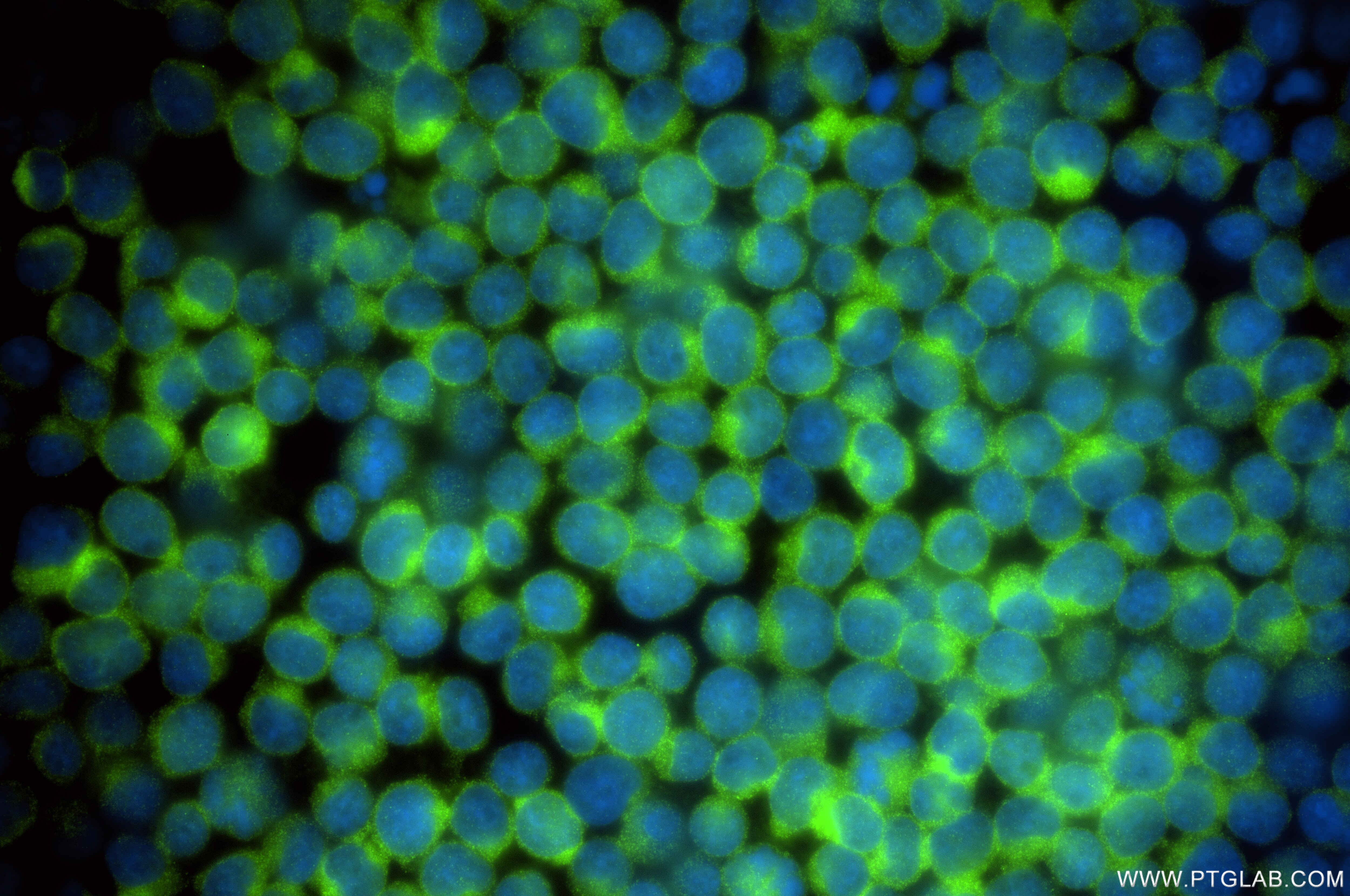 Immunofluorescence (IF) / fluorescent staining of Jurkat cells using VAV1 Recombinant monoclonal antibody (86933-2-RR)