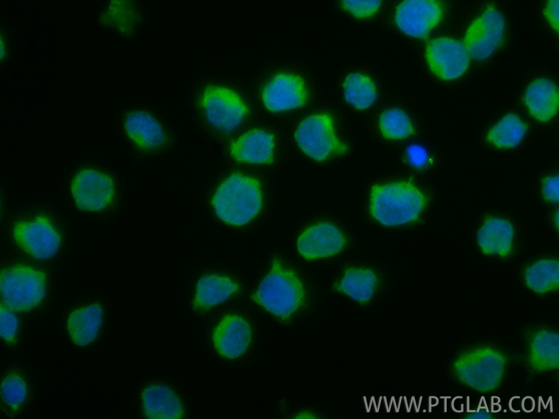 IF Staining of Jurkat using CL488-86933-2 Immunofluorescence (IF) / fluorescent staining of Jurkat cells using CoraLite® Plus 488-conjugated VAV1 Recombinant mon (CL488-86933-2)
