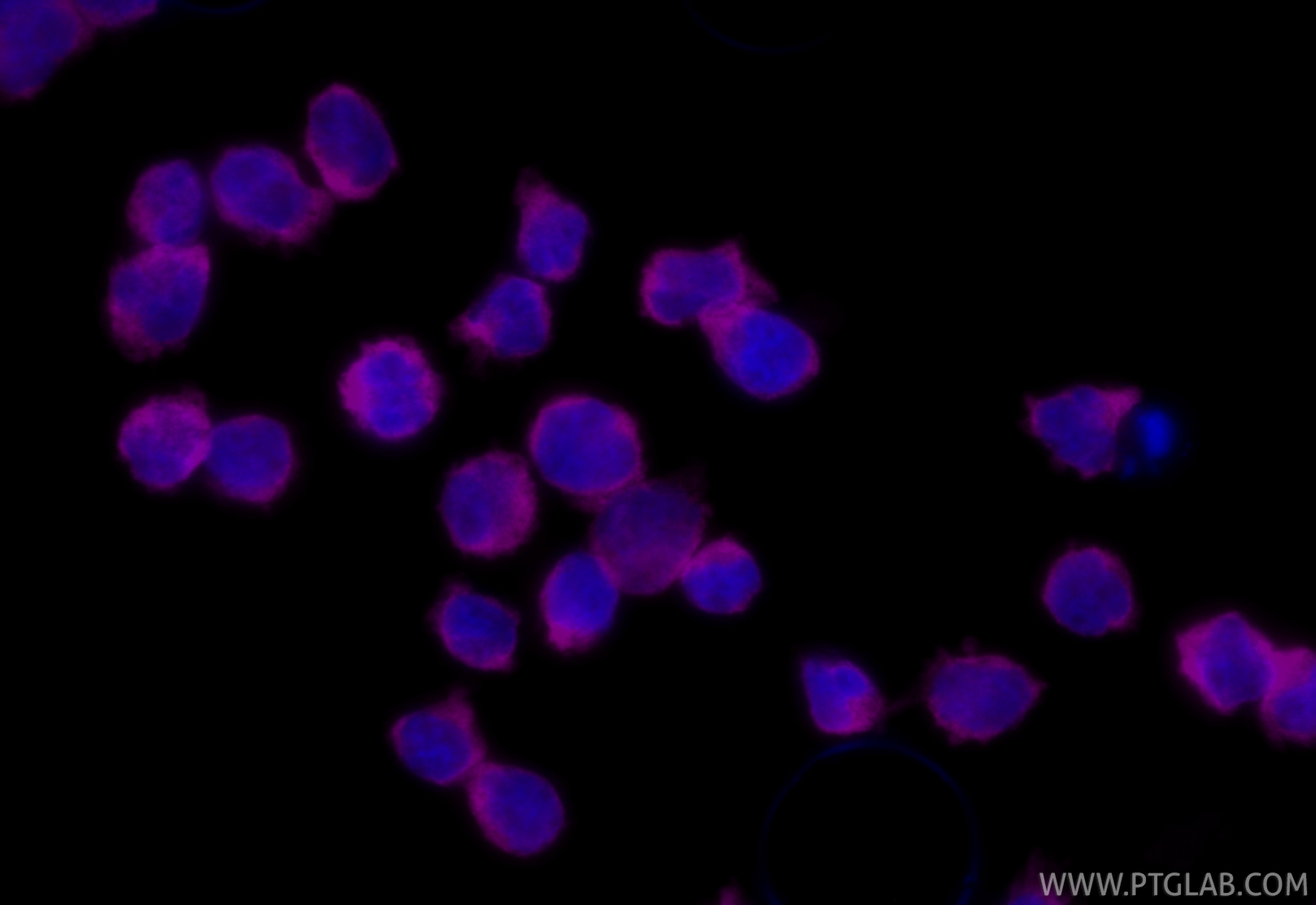 Immunofluorescence (IF) / fluorescent staining of Jurkat cells using CoraLite® Plus 647-conjugated VAV1 Recombinant mon (CL647-86933-2)