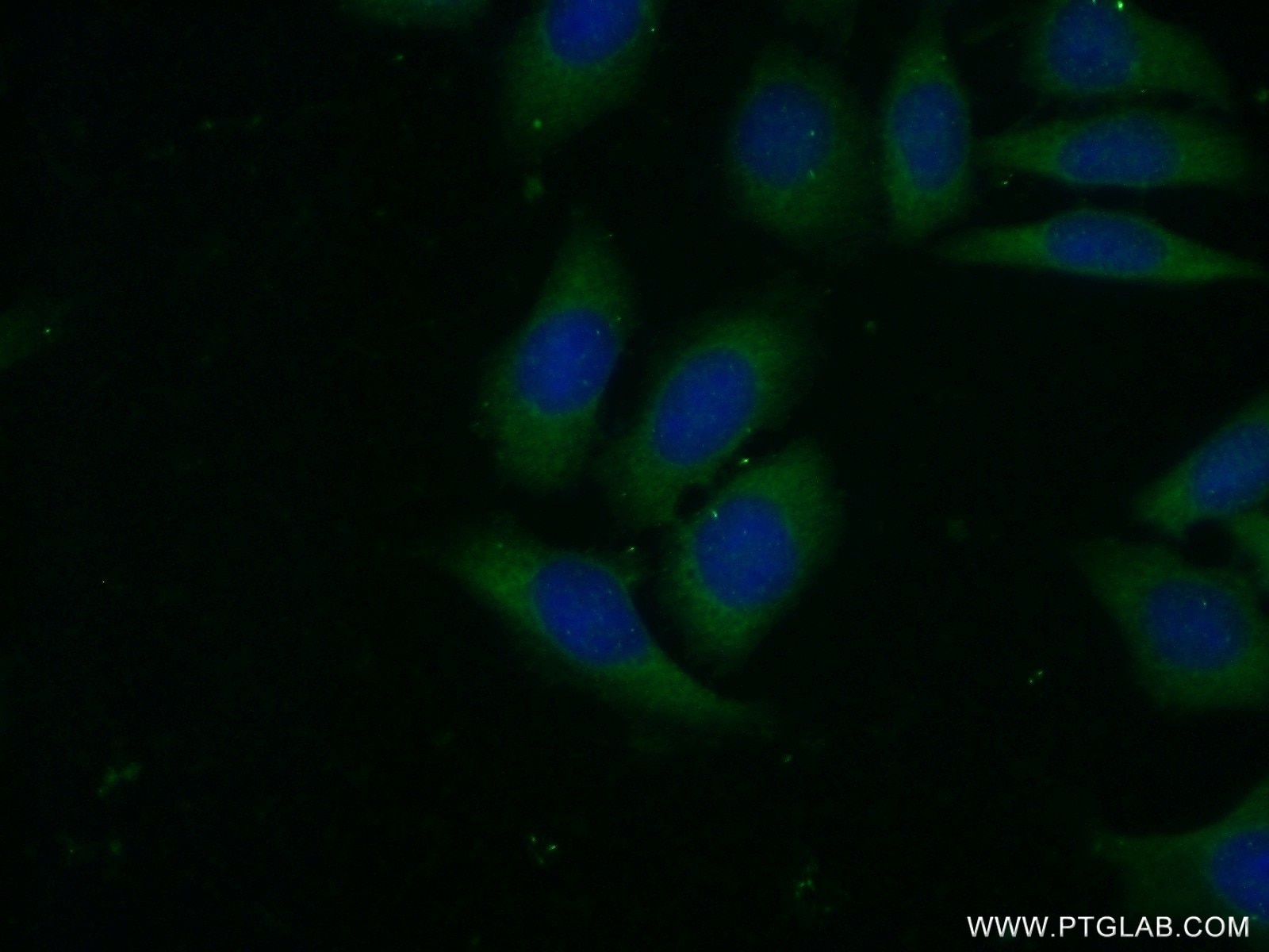 Immunofluorescence (IF) / fluorescent staining of HeLa cells using VAV2 Polyclonal antibody (21924-1-AP)