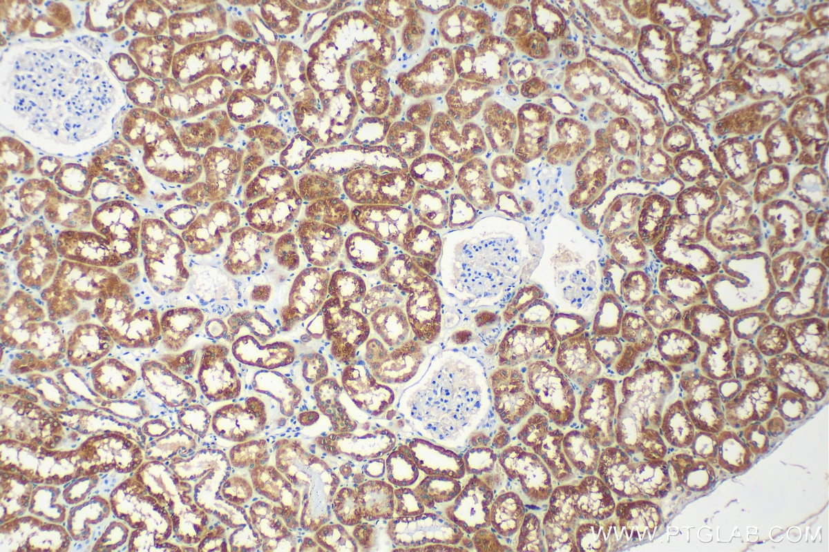 Immunohistochemistry (IHC) staining of human kidney tissue using VAV2 Polyclonal antibody (21924-1-AP)