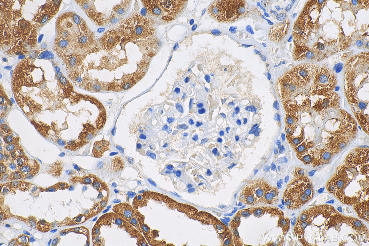 Immunohistochemistry (IHC) staining of human kidney tissue using VAV2 Polyclonal antibody (21924-1-AP)