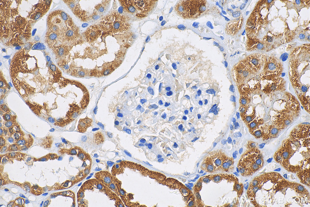 IHC staining of human kidney using 21924-1-AP