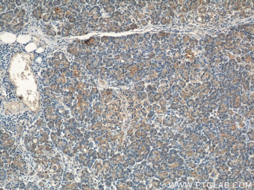 Immunohistochemistry (IHC) staining of human pancreas tissue using VAV2 Polyclonal antibody (21924-1-AP)