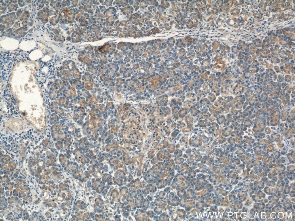 Immunohistochemistry (IHC) staining of human pancreas tissue using VAV2 Polyclonal antibody (21924-1-AP)