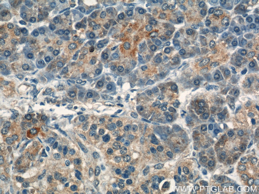 Immunohistochemistry (IHC) staining of human pancreas tissue using VAV2 Polyclonal antibody (21924-1-AP)