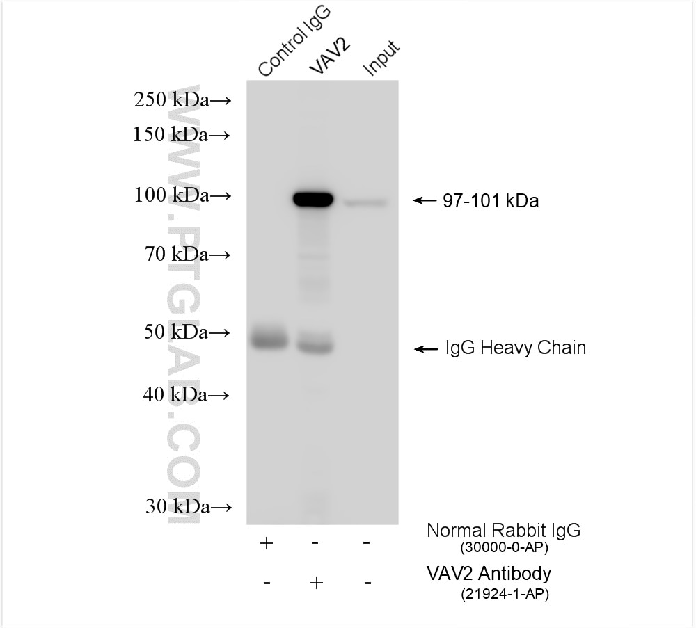 Immunoprecipitation (IP) experiment of HeLa cells using VAV2 Polyclonal antibody (21924-1-AP)