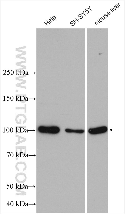 Western Blot (WB) analysis of various lysates using VAV2 Polyclonal antibody (21924-1-AP)