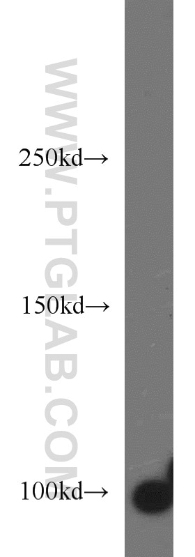 Western Blot (WB) analysis of HEK-293 cells using VAV2 Polyclonal antibody (21924-1-AP)