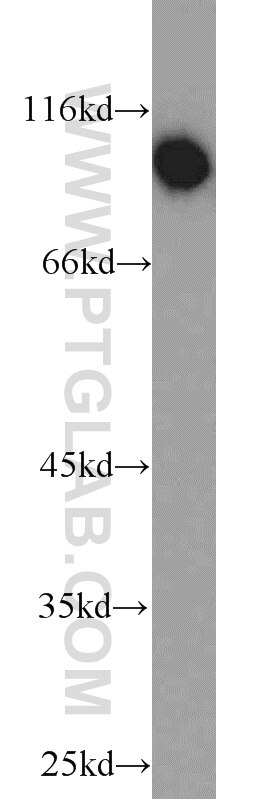 Western Blot (WB) analysis of mouse brain tissue using VAV2 Polyclonal antibody (21924-1-AP)