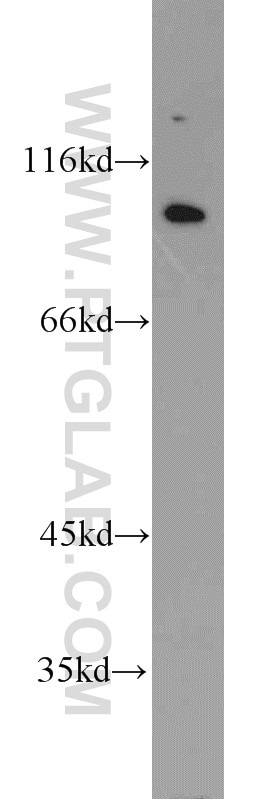 Western Blot (WB) analysis of A431 cells using VAV2 Polyclonal antibody (21924-1-AP)