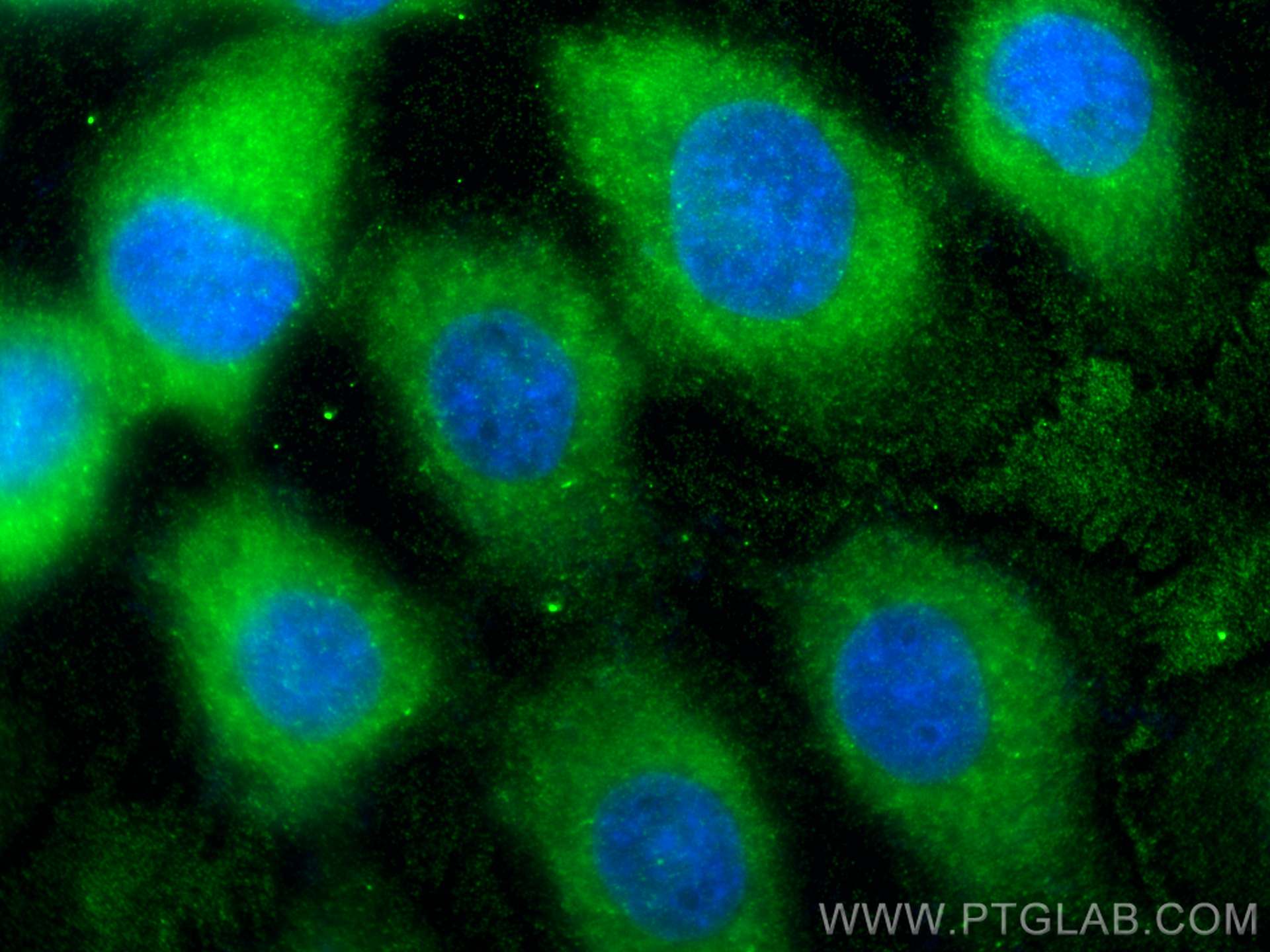 Immunofluorescence (IF) / fluorescent staining of A431 cells using VAV2 Monoclonal antibody (67108-1-Ig)