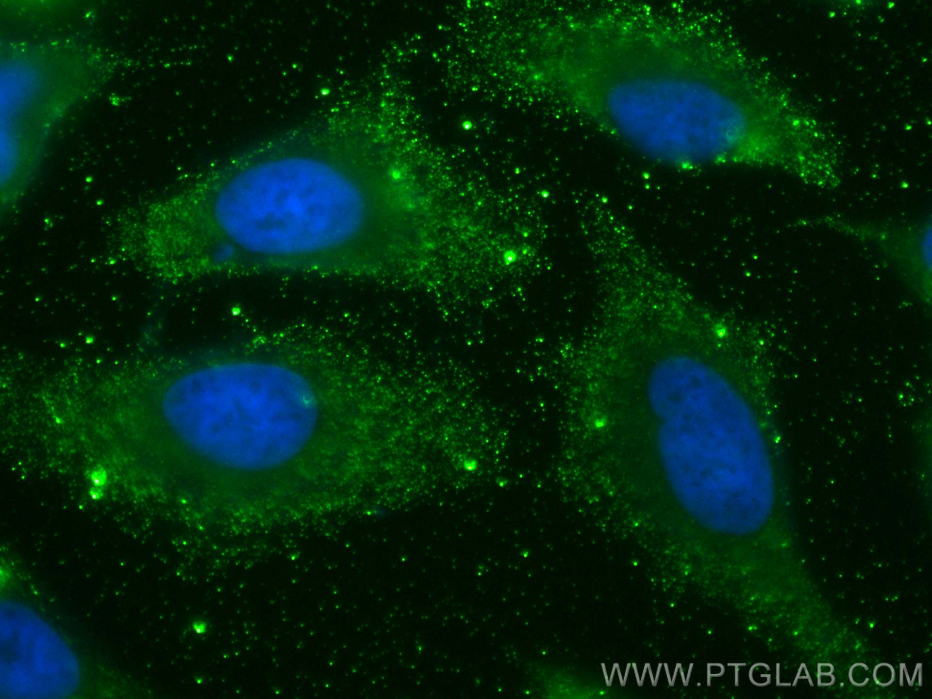 Immunofluorescence (IF) / fluorescent staining of HeLa cells using VAV2 Monoclonal antibody (67108-1-Ig)