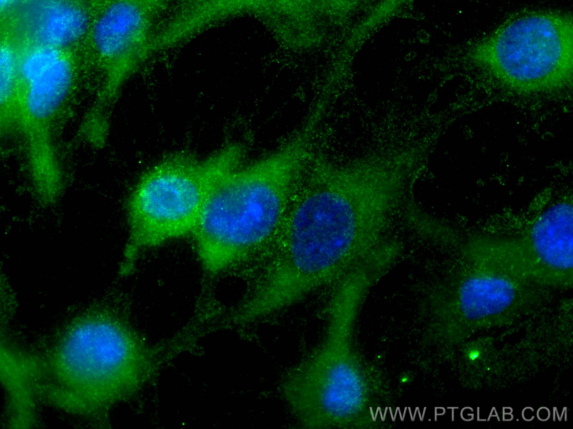 Immunofluorescence (IF) / fluorescent staining of HUVEC cells using VAV2 Monoclonal antibody (67108-1-Ig)