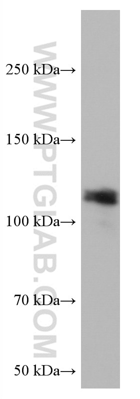 Western Blot (WB) analysis of A431 cells using VAV2 Monoclonal antibody (67108-1-Ig)