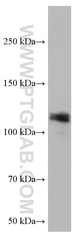 WB analysis of A431 using 67108-1-Ig