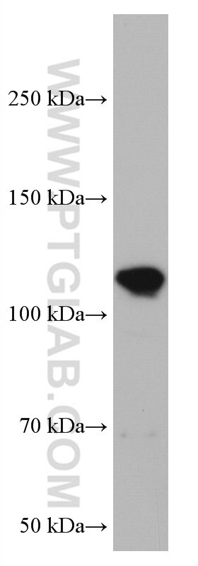 Western Blot (WB) analysis of HeLa cells using VAV2 Monoclonal antibody (67108-1-Ig)