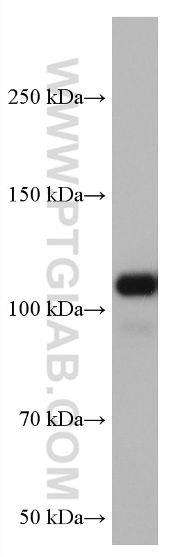 Western Blot (WB) analysis of fetal human brain tissue using VAV2 Monoclonal antibody (67108-1-Ig)