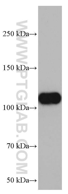 Western Blot (WB) analysis of pig brain tissue using VAV2 Monoclonal antibody (67108-1-Ig)