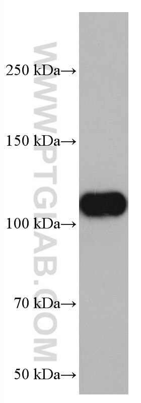 WB analysis of pig brain using 67108-1-Ig