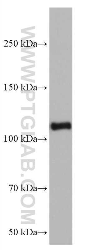 Western Blot (WB) analysis of rat brain tissue using VAV2 Monoclonal antibody (67108-1-Ig)