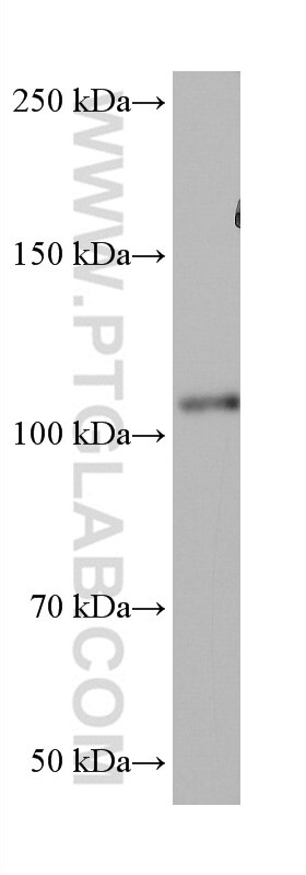 Western Blot (WB) analysis of mouse brain tissue using VAV2 Monoclonal antibody (67108-1-Ig)