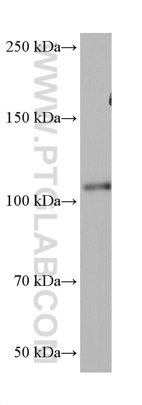 Western Blot (WB) analysis of mouse brain tissue using VAV2 Monoclonal antibody (67108-1-Ig)