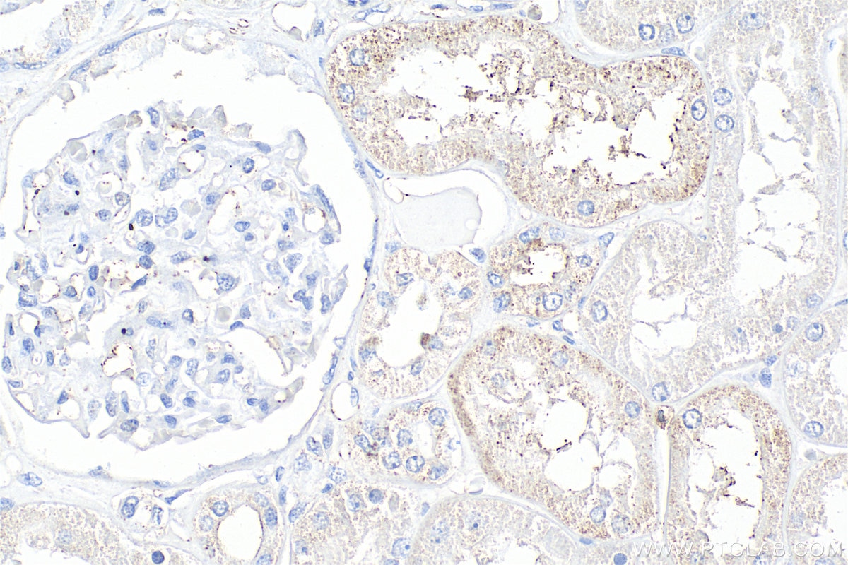 Immunohistochemical analysis of paraffin-embedded human kidney tissue slide using 30291-1-AP (VAV3 antibody) at dilution of 1:200 (under 40x lens). Heat mediated antigen retrieval with Tris-EDTA buffer (pH 9.0). Immunohistochemistry (IHC) staining of human kidney tissue using VAV3 Polyclonal antibody (30291-1-AP)