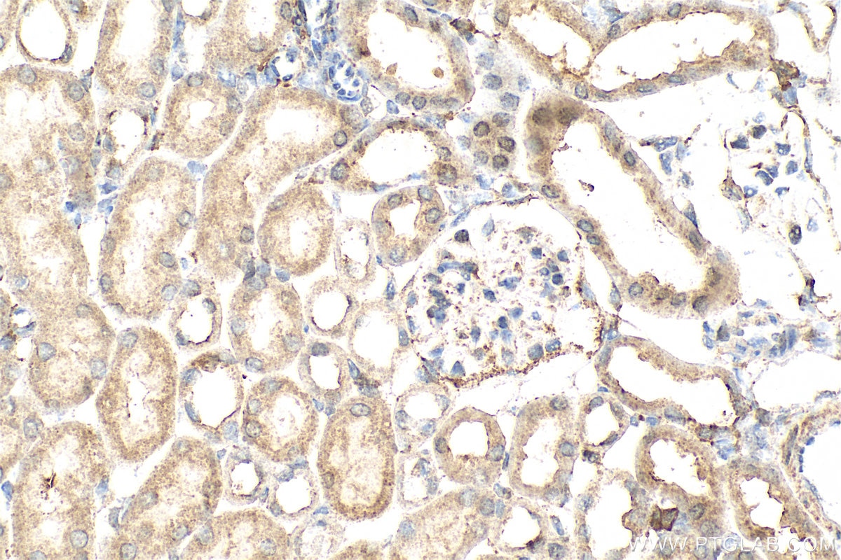 Immunohistochemical analysis of paraffin-embedded mouse kidney tissue slide using 30291-1-AP (VAV3 antibody) at dilution of 1:200 (under 40x lens). Heat mediated antigen retrieval with Tris-EDTA buffer (pH 9.0). Immunohistochemistry (IHC) staining of mouse kidney tissue using VAV3 Polyclonal antibody (30291-1-AP)