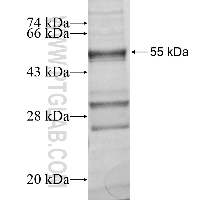 VAX1 fusion protein Ag12813 SDS-PAGE
